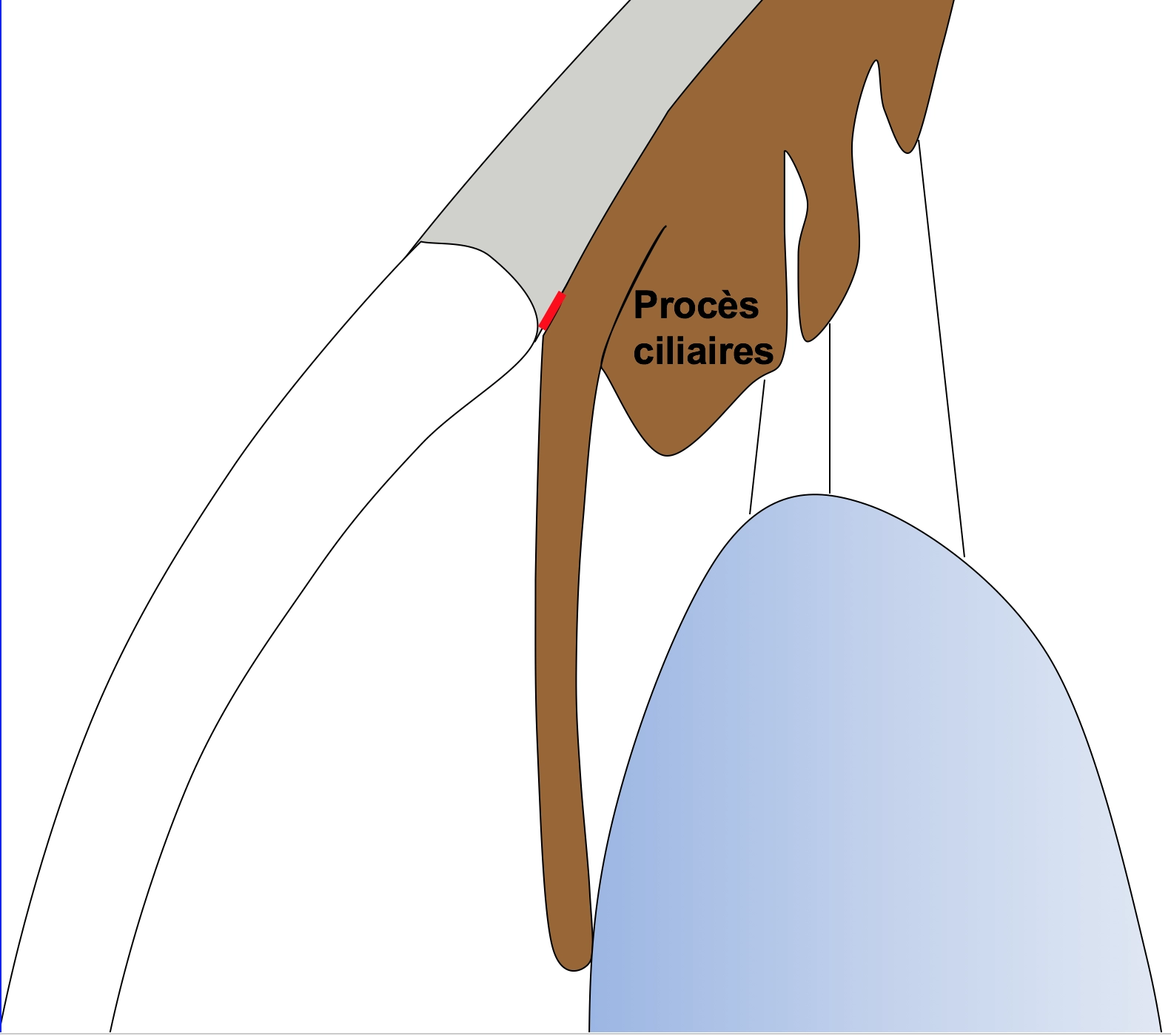 Schéma d'Iris plateau avant iridotomie