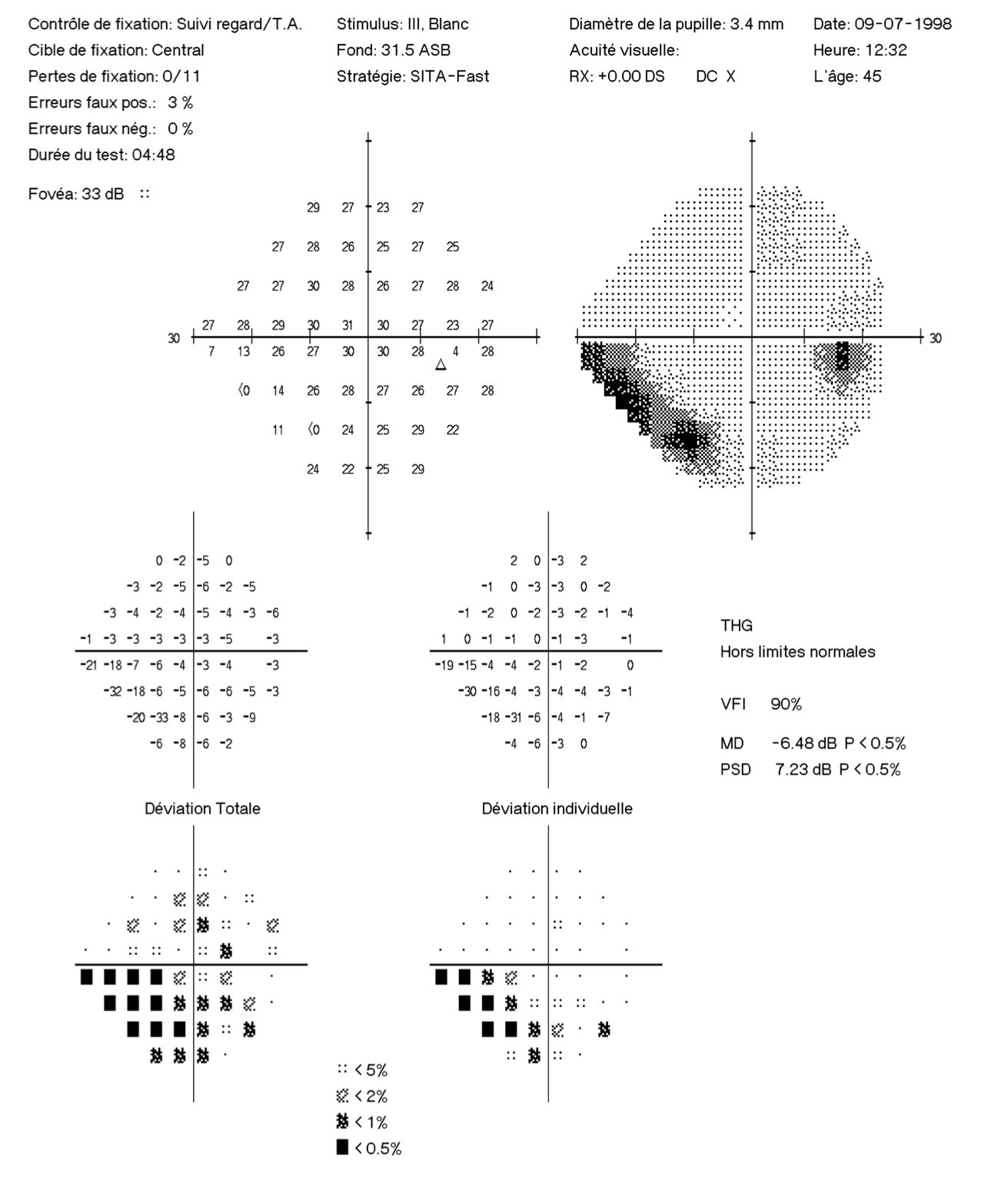 Imprimé type d'un champ visuel zoomé