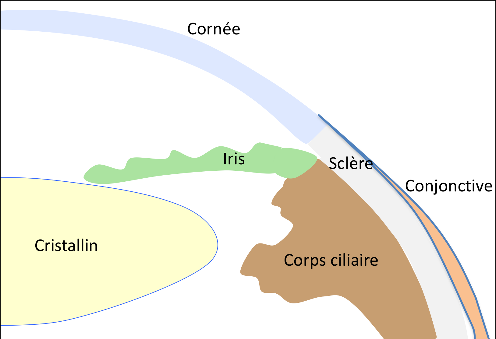 Schéma d'une opération du glaucome : début